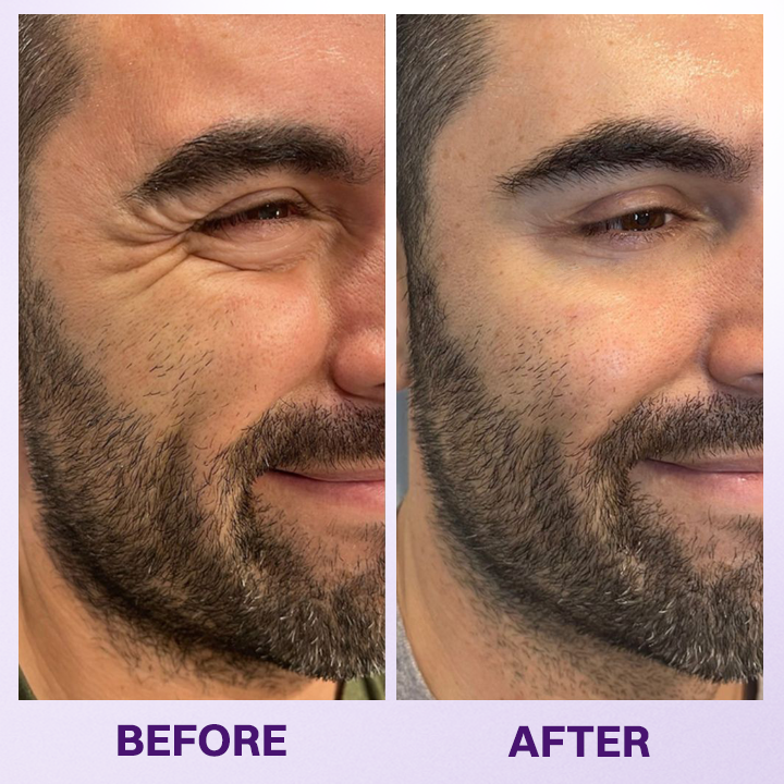 Healthzeri Refreshing Eye Gel product image 09